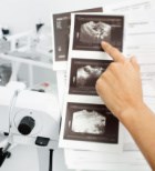 בעיות פוריות ונשיאת הריון - תמונת המחשה